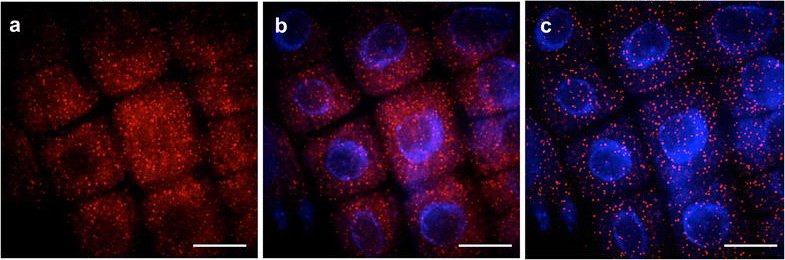 Advancing the ability to image single RNA molecules at the cellular level