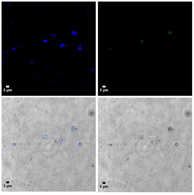 Figure 3: (A) DAPI-stained, (B) chlorophyll autofluorescence, and (C) DAPI-BF merged and (D) brightfield images of the nuclei isolated with the protocol from Sikorskaite et al. (2013) . The cyan arrows point to DAPI-stained nuclei.